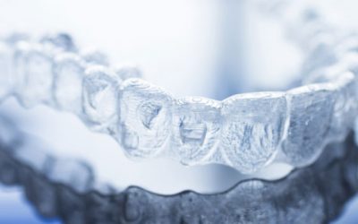 Cos’è l’apparecchio trasparente Invisalign?