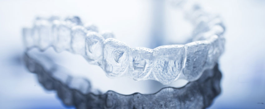 Cos’è l’apparecchio trasparente Invisalign?